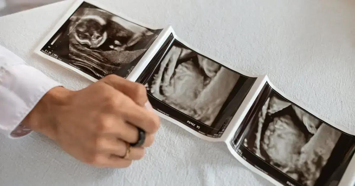 10. Alimentação e cuidados após a alta hospitalar